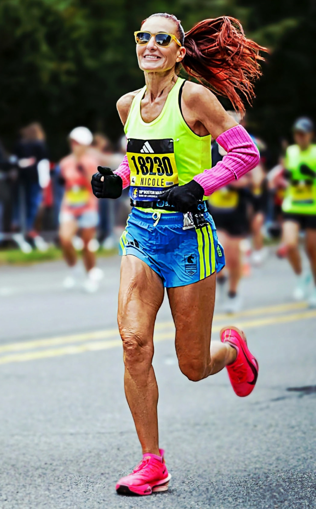 Plantar Fasciitis Treatment